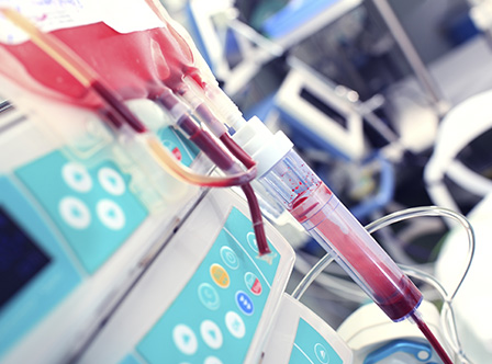 A close-up of a blood transfusion.